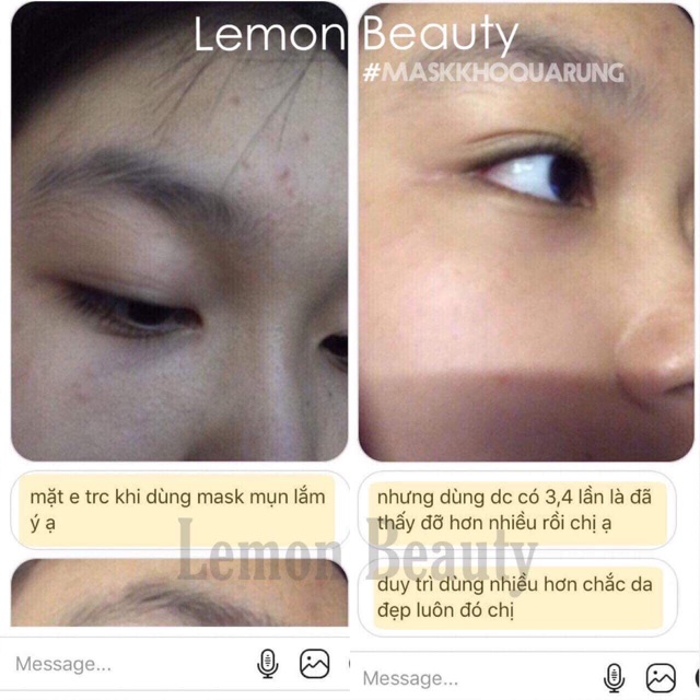 [ MUA 1 MASK TẶNG 1 MASK ] MASK KHỔ QUA RỪNG SALE 84K 🎁 MASK MÔI + CỌ + THÌA PHA | BigBuy360 - bigbuy360.vn