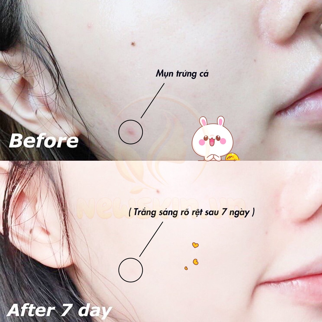 Kem hỗ trợ giảm mụn Phục hồi da Medi-Peel Centella Mezzo Cream 30ml
