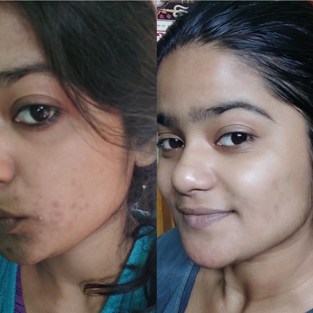 Serum trắng da CAO CẤP 15% Niacinamide 3% Alpha Arbutin