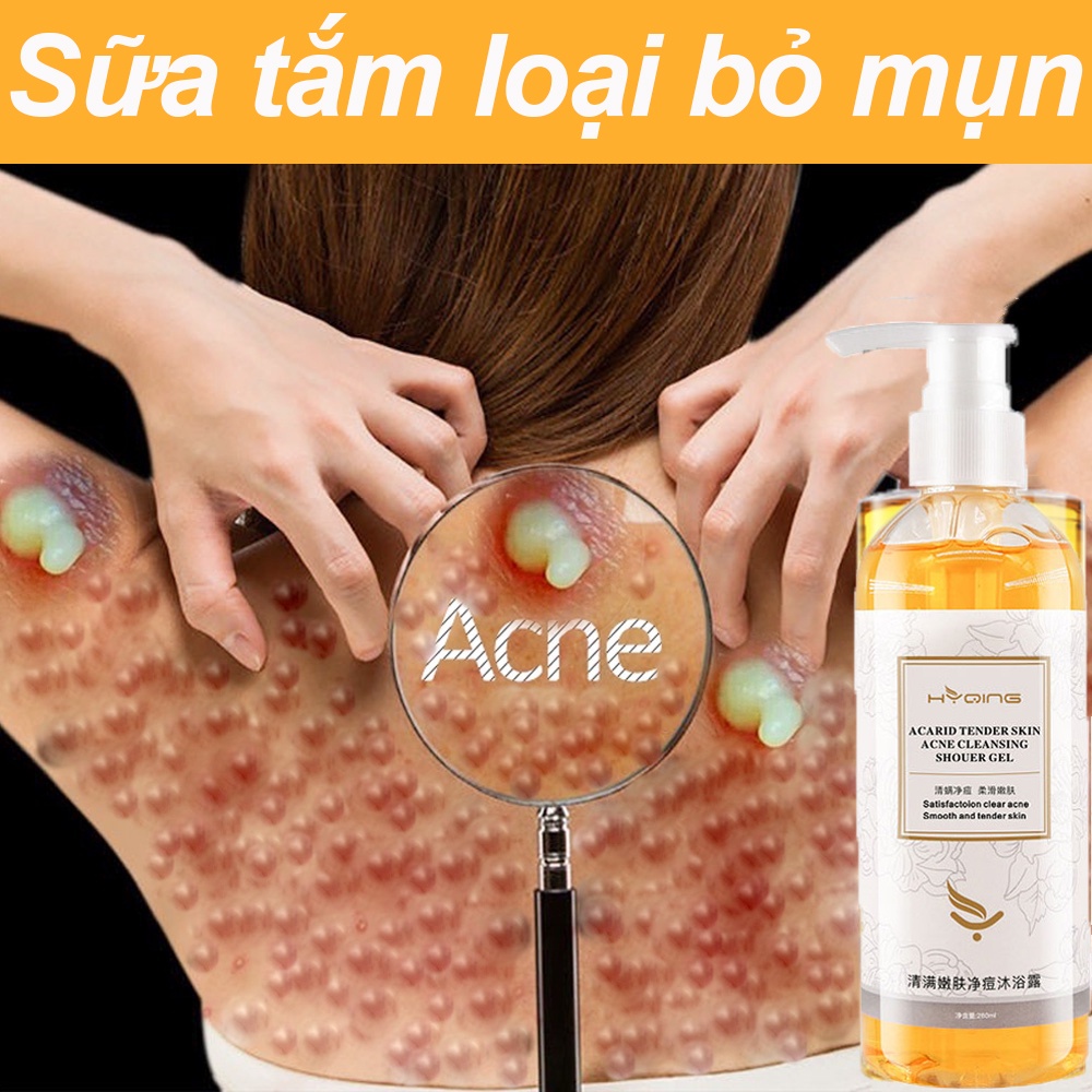 Sữa tắm trắng da Sữa tắm loại bỏ mụn 260ml loại bỏ mạt cải thiện lưng mụn làm trắng và giữ ẩm làm sạch mụn khô