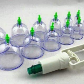 Bộ giác hơi ko dùng lửa