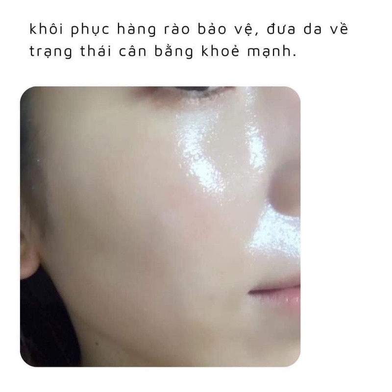 [CHÍNH HÃNG CTY] Serum 𝐆𝐄𝐋 𝐇𝐀 + 𝐁𝟓 -𝐆𝐞𝐥 𝐝𝐮̛𝐨̛̃𝐧𝐠 𝐚̂̉𝐦 𝐯𝐚̀ 𝐩𝐡𝐮̣𝐜 𝐡𝐨̂̀𝐢 𝐝𝐚 𝐖𝐞𝐥𝐥𝐦𝐚𝐱𝐱 𝐇𝐲𝐚𝐥𝐮𝐫𝐨𝐧 𝐌𝐨𝐢𝐬𝐭 𝐈𝐧𝐭𝐞𝐧𝐬𝐞 𝐆𝐞𝐥 𝐂𝐨𝐧𝐜𝐞𝐧𝐭𝐫𝐚𝐭𝐞