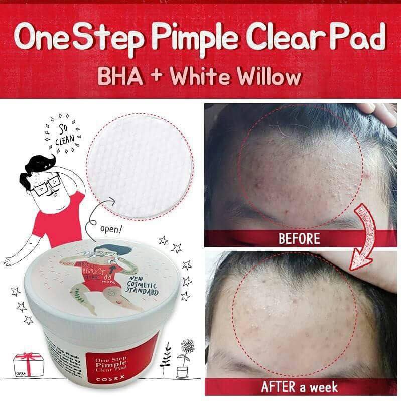 Bông tẩy da chết dành cho da dầu, mụn Cosrx One Step Pimple Clear Pad