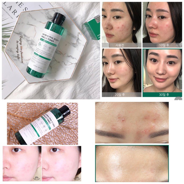  Nước Hoa Hồng SOME BY MI Cho Da Mụn Miracle Toner AHA- BHA-PHA