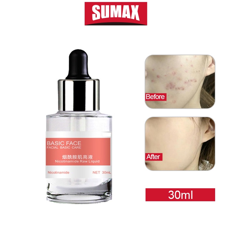 Serum dưỡng da SUMAX chứa Niacinamide Axit Hyaluronic B5 Alpha Arbutin Caffeine Lactic Acid Retinol 30ml hiệu quả