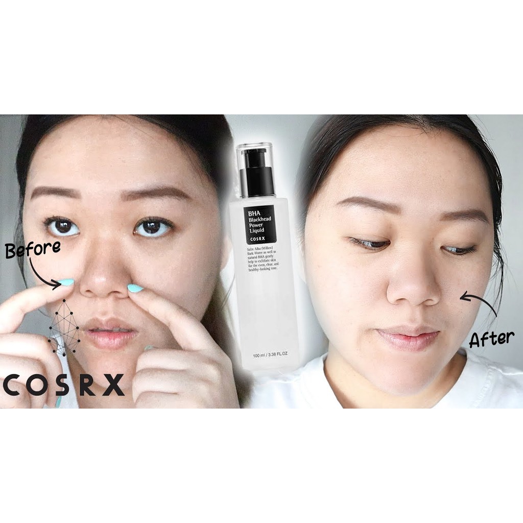 Tẩy Da chết COSRX BHA Blackhead Power Liquid