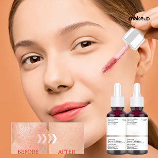 [Hàng mới về] Tinh chất dưỡng ẩm thu nhỏ lỗ chân lông chăm sóc da mặt 30ml