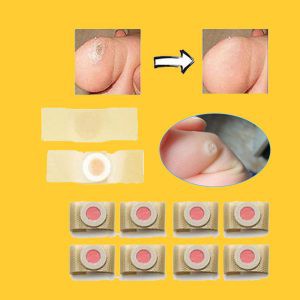 [CHÍNH HÃNG] TÚI 4 MIẾNG DÁN MỤN CÓC, MỤN CƠM, MẮT CÁ PLASTER | BigBuy360 - bigbuy360.vn