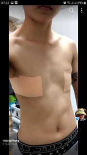 Phong Cách TomBoy [ Keo Vải Dán Định Hình Ngực Phẳng ]