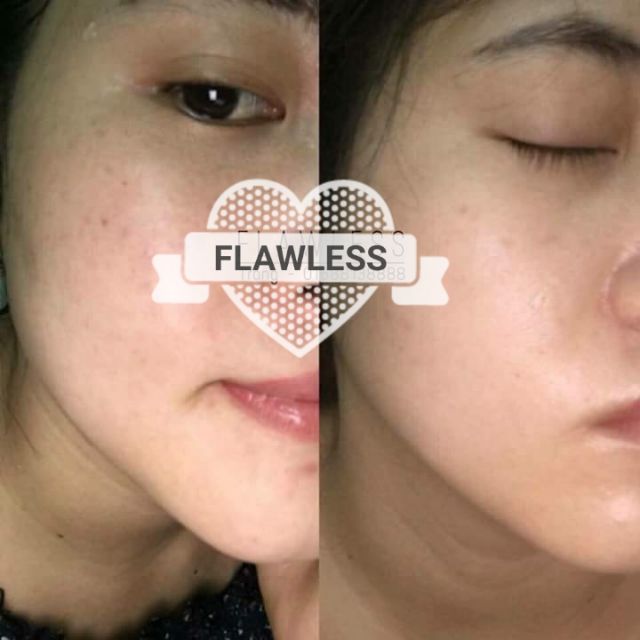 MÁY RỬA MẶT ĐẦU CỌ NANO FLAWLESS- CN NHẬT BẢN