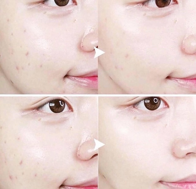 Sữa rửa mặt ngăn ngừa mụn Innisfree Bija Trouble Facial Foam - Guu