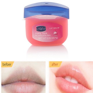 Dưỡng môi Vaseline_CHÍNH HÃNG