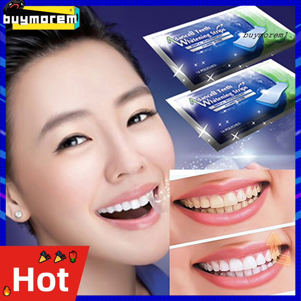 Set 2 miếng dán trắng răng siêu nhẹ sử dụng tiện lợi