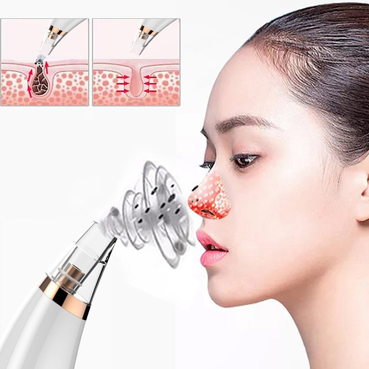 Máy hút mụn mini Black Head Detector