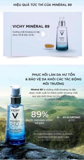 Serum vichy