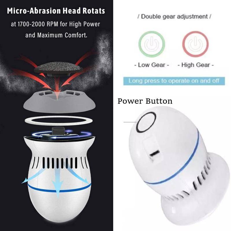 Máy Mài Chân Loại Bỏ Vết Chai Cứng Trên Bàn Chân Sạc Lại Được Tiện Lợi Dành Cho Da Bị Nứt Nẻ