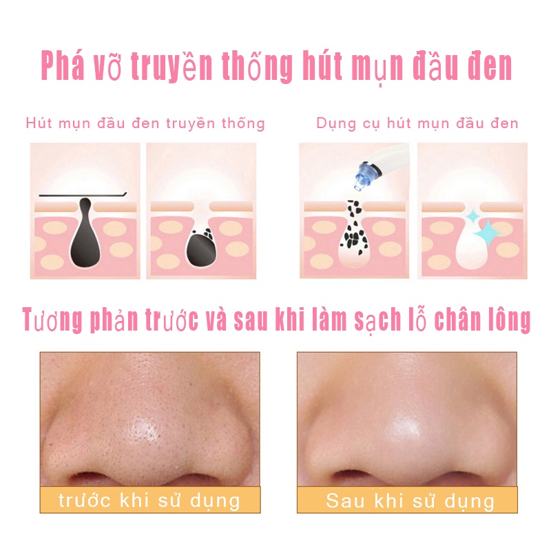 Máy Hút Mụn Hút Sạch Tất Cả Các Loại Mụn Với 3 Đầu Hút Thông Minh An Toàn Không Đau Rát Tiện Lợi Làm Sạch Lỗ Chân Lông