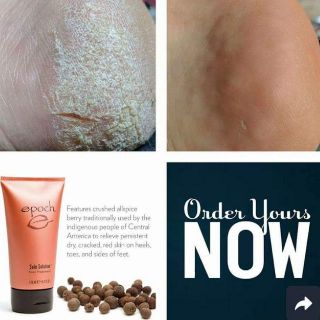 KEM TRỊ NỨT GÓT CHÂN