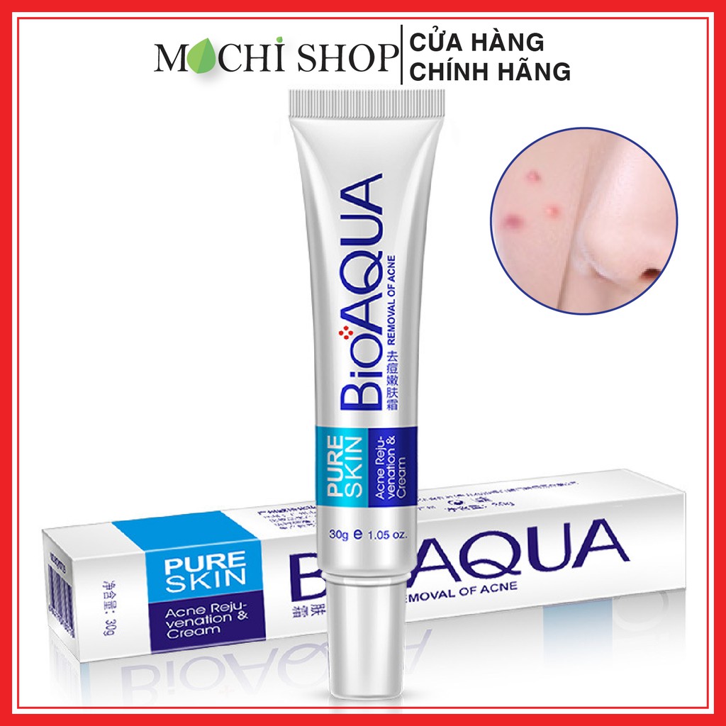 Kem Giảm Mụn, Sạch Mụn, Ngừa Mụn Đầu Đen, Mụn Đỏ, Mụn Cám Acne Bioaqua Sạch Bã Nhờn, Dưỡng Ẩm Chính Hãng - MOCHI SHOP | BigBuy360 - bigbuy360.vn