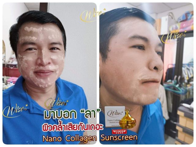 Kem Wises Nano collagen thái lan