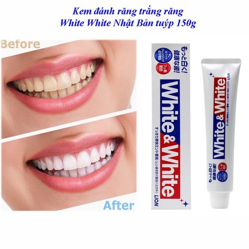 Kem đánh răng White &amp; White nội địa Nhật giúp trắng răng sạch khuẩn tuýp 150g - 𝐁𝐞𝐞 𝐡𝐨𝐮𝐬𝐞