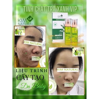 TINH CHẤT TRÀ XANH VIP KIMNATURAL (MẪU MỚI)