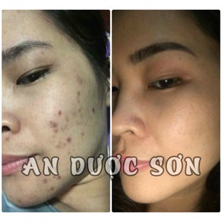 Serum An Dược Sơn chai 30ml