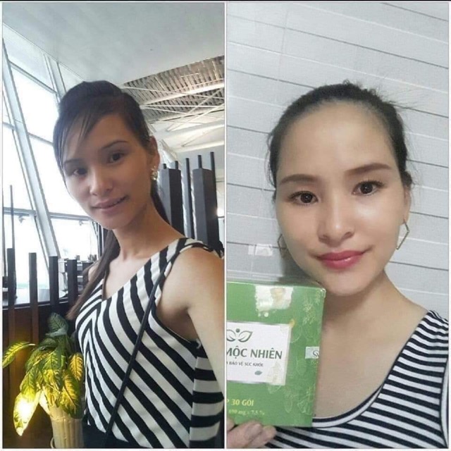 Tăng mộc nhiên, TĂNG CÂN CHO NGƯỜI GẦY - HÀNG CHÍNH HÃNG - giá sỉ | Thế Giới Skin Care