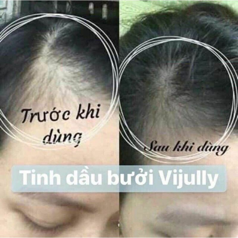 Xịt Bưởi Vijully kích mọc tóc , ngăn rụng tóc