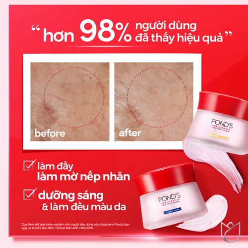 Bộ Sản Phẩm Kem Dưỡng Da POND'S Age Miracle Chống Lão Hoá Ngày Và Đêm 50g x 2