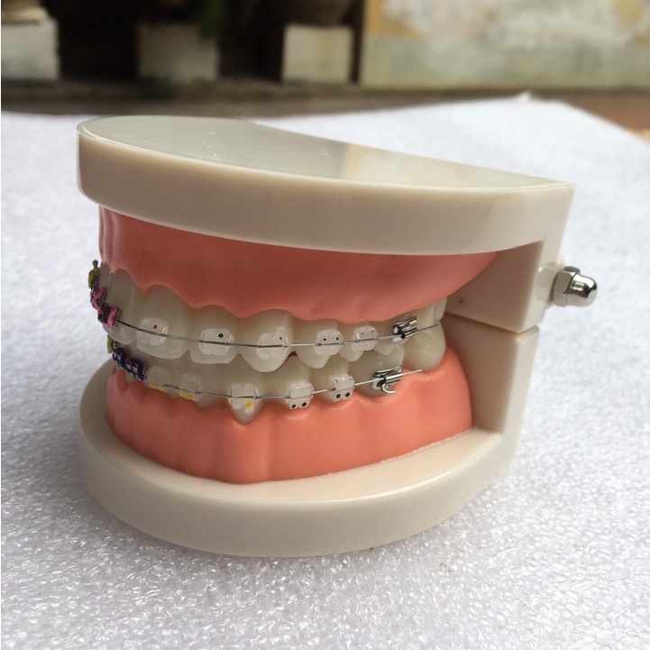 Mẫu hàm tư vấn nha khoa - Mẫu hàm tư vấn gắn mắc cài 2in1