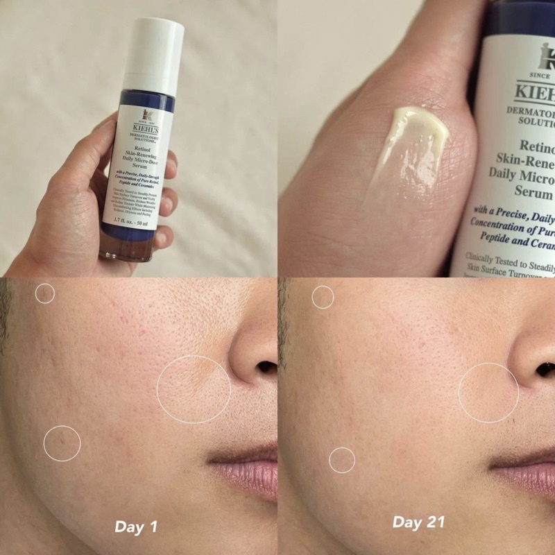 30ml / 50ml - Tinh chất Retinol Kiehls / Kiehl’s Retinol Micro Dose