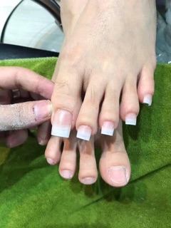 MÓNG NỐI - ĐẮP CHÂN