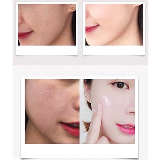 TONER HƯƠNG THẢO MỤN ẨN , MỤN BỌC toner verbenone rosemary dew VENZEN