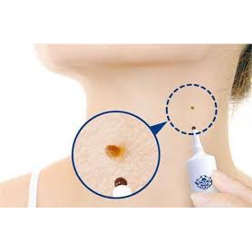 Kem bôi mụn ruồi tsubuporon night patch 20g nhật bản