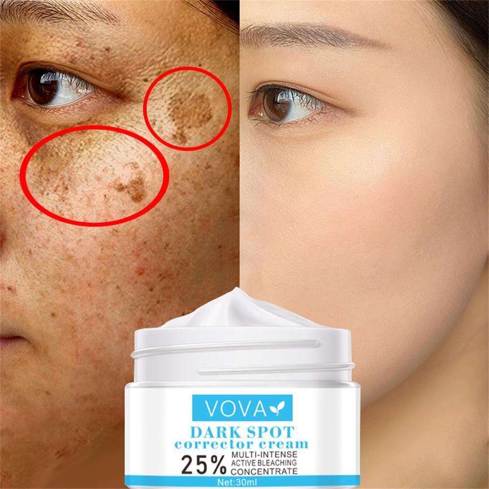 Kem Làm Trắng Da Mặt Loại Bỏ Melanin Dưỡng Ẩm Hiệu Quả
