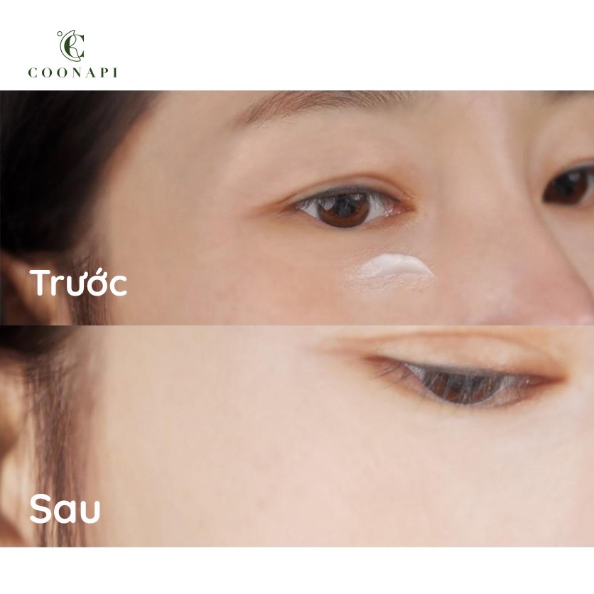 Kem Dưỡng Da Vùng Mắt Giảm Nhăn Và Thâm Quầng Mắt Thiên Nhiên Thảo Mộc Nature's Friend Eye & Nourishing Cream 40g | BigBuy360 - bigbuy360.vn