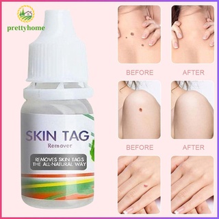 (Hàng Mới Về) Thuốc Mỡ Trị Mụn Cóc Dung Tích 10ml