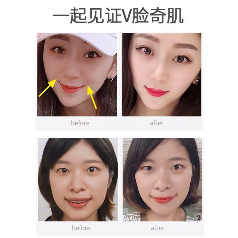 Dụng cụ nâng cơ mặt tạo cằm chữ V cải thiện da mặt | BigBuy360 - bigbuy360.vn
