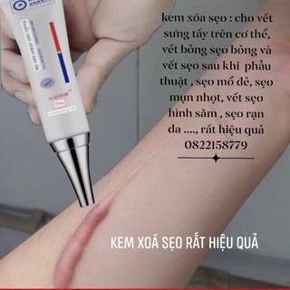 Kem thoa sẹo : vết bỏng sẹo bỏng và vết sẹo sau khi phẫu thuật , sẹo mổ đẻ, sẹo mụn nhọt, vết sẹo hình săm , sẹo rạn da