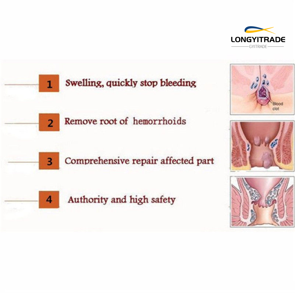 (hàng Mới Về) Kem Trị Bệnh Trĩ Giảm Đau Chăm Sóc Sức Khỏe Tiện Dụng