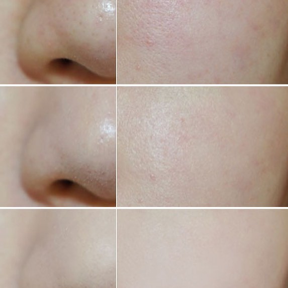 Phấn rôm, phấn phủ dạng nén shiseido powder baby | BigBuy360 - bigbuy360.vn