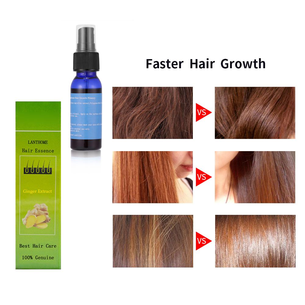 Tinh dầu chống mất kích thích mọc tóc 30ml