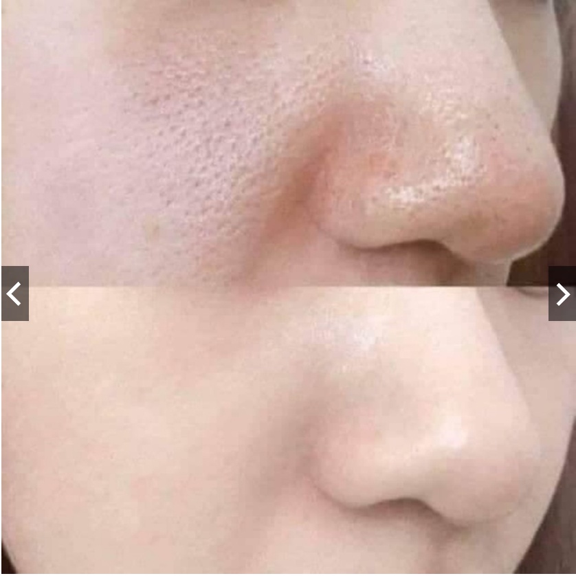 Tế bào gốc POCIA giảm lỗ chân lông to lọ 10ml