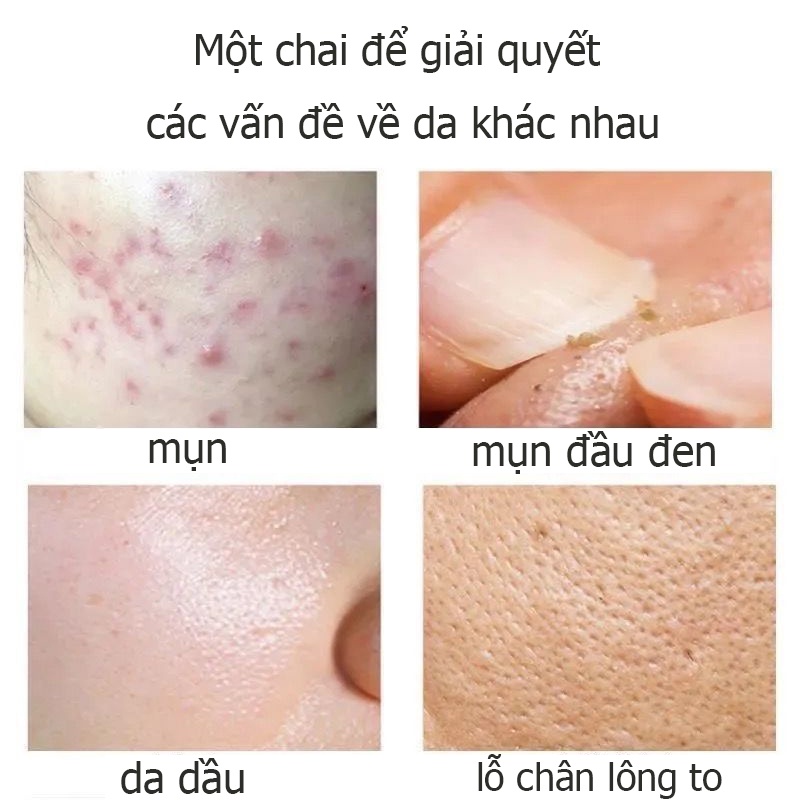 Sữa rửa mặt axit amin, Kiểm soát dầu và mụn Sữa rửa mặt[150ml], Làm sạch chuyên sâu, Soảng khoái nẩy da, Căn bằng nước và dầu, dưỡng ẩm làm trắng, thu nhỏ lỗ chân lông, kiểm soát dầu, mụn, da mẫn cảm cũng có thể sử dụng