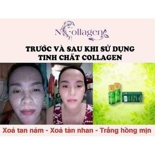 Tinh Chất face Collagen