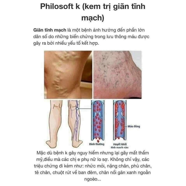 KEM GIẢM SUY GIÃN TĨNH MẠCH CHÂN PHILOSOFT THÁI LAN CHÍNH HÃNG - 8344