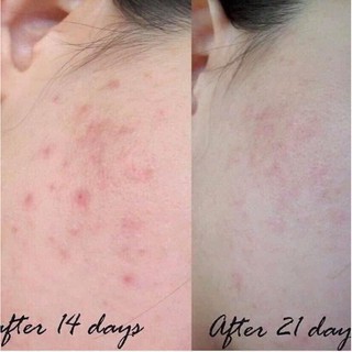 Serum Vit C Balance 30ml