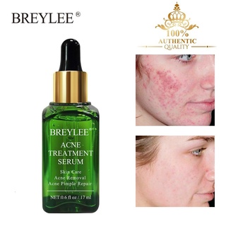 Serum Breylee 17ml Hỗ Trợ Giảm Mụn Sẹo Làm Trắng Da Hiệu Quả