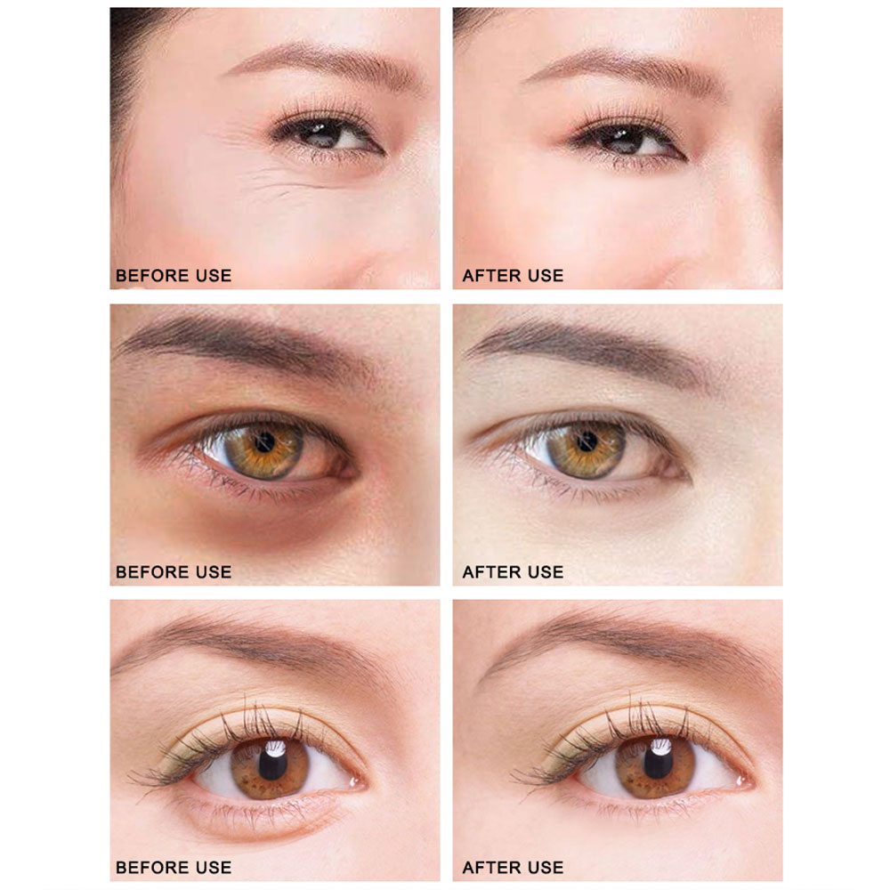 [Hàng mới về] Set 60 mặt nạ ngọc trai đen và collagen dưỡng ẩm ngừa quầng thâm và bọng mắt hiệu quả cao | BigBuy360 - bigbuy360.vn